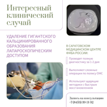 Уникальный случай в хирургии СМЦ ФМБА: удаление гигантского кальцинированного образования лапароскопическим доступом