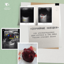 «Случайные находки»: как ультразвуковая диагностика в СМЦ ФМБА России спасает жизни