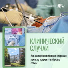 Клинический случай: Как лапароскопическая операция помогла избежать стомы